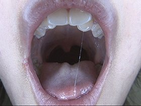 300人のおくち 第2集　サンプル画像03